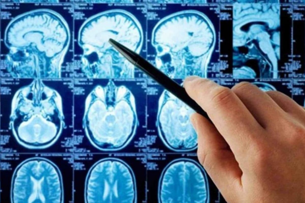 Juiz obriga Secretaria de Saúde de Goiás a providenciar cirurgia em paciente com tumor cerebral